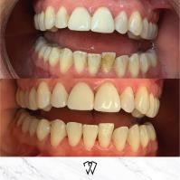 Wisdom Dental image 13