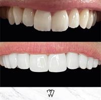 Wisdom Dental image 28