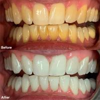 Wisdom Dental image 34