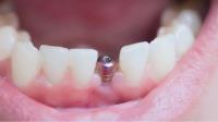 Acton Dentist Roxdental image 4
