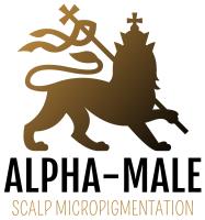 Alpha-Male Scalp Micropigmentation image 1