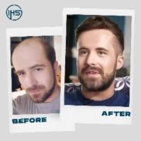 IHS Hair Replacement  image 1