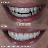 Love Teeth Dental - Stonecot image 4