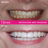 Love Teeth Dental - Stonecot image 5