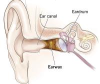 Clear Ear - Micro suction Specialist image 2