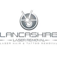 Lancashire Laser Removal image 1