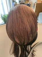 Hair Loss and Scalp Clinic image 2
