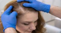 Hair Loss and Scalp Clinic image 4