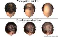 Hair Loss and Scalp Clinic image 5