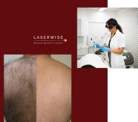 LaserWise Skin & Beauty Clinic image 5