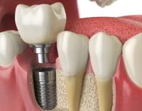 Perla Dental Clinic image 2