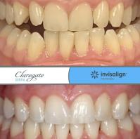 Claregate Dental Practice image 6