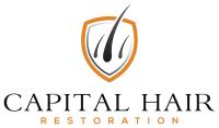 Capital Hair Restoration - Hair Transplant image 12