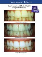 Crest 3d Whitening Strips UK image 2