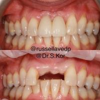 Russell Avenue Dental and Implant Centre image 3