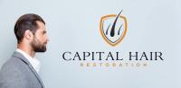 Capital Hair Restoration - Hair Transplant image 2