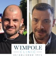 Wimpole Hair Transplant Clinic Glasgow image 2