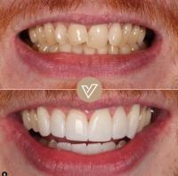 VICI Dental | Pudsey image 5