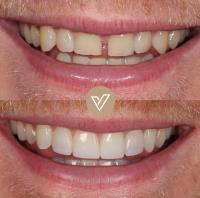 VICI Dental | Pudsey image 7