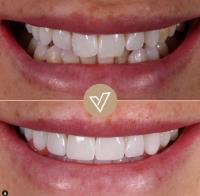 VICI Dental | Pudsey image 8