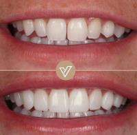 VICI Dental | Pudsey image 9