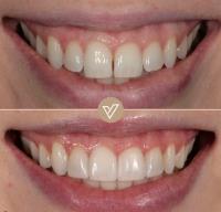 VICI Dental | Pudsey image 12