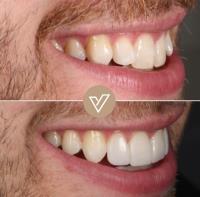 VICI Dental | Pudsey image 19