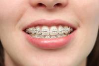 Orthodontic Manchester image 1