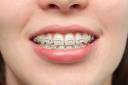 Orthodontic Manchester logo