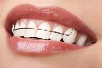 Orthodontic Manchester image 2