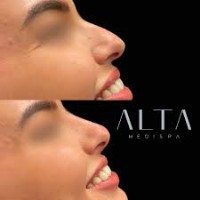 Alta Medispa image 2