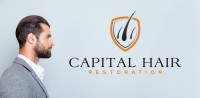 Capital Hair Restoration - Hair Transplant image 6