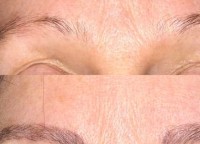 Pure Precision Microblading image 1