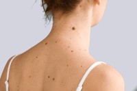 Dermconsult Dermatology Clinic image 5