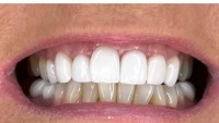 Parklands Dental Practice - Monmouth image 1