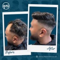 IHS Hair Replacement London image 5