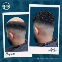 IHS Hair Replacement London image 4