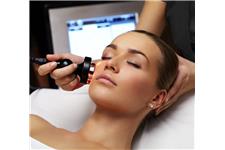 Rosacea Treatment - The Laser Treatment Clinic image 2