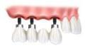 DentalCarePlus Dental Implant Centre Cornwall image 1