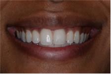 Gipsy Lane Advanced Dental Care image 5