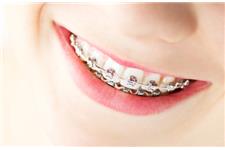 Hungary Dental Implant  image 4