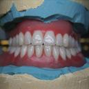 Birches Head Denture Clinic image 5