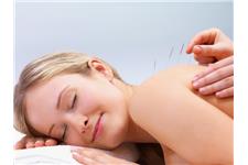 Wye Valley Acupuncture image 1