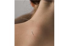 Amanda Silcock - Acupuncture in York image 6