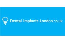 Dental Implants London image 1