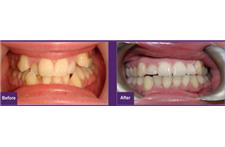 Andover Smile Centre image 3