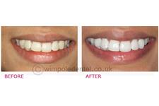 Wimpole Dental image 1