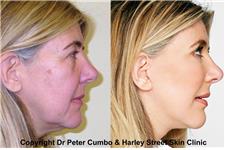 Harley Street Skin Clinic image 4