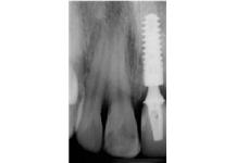 Andover Dental Practice Ltd image 4