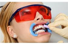 Laser Bright Teeth Whitening image 1